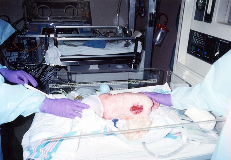 0-02.JPG - This is the opening in her back right after birth.