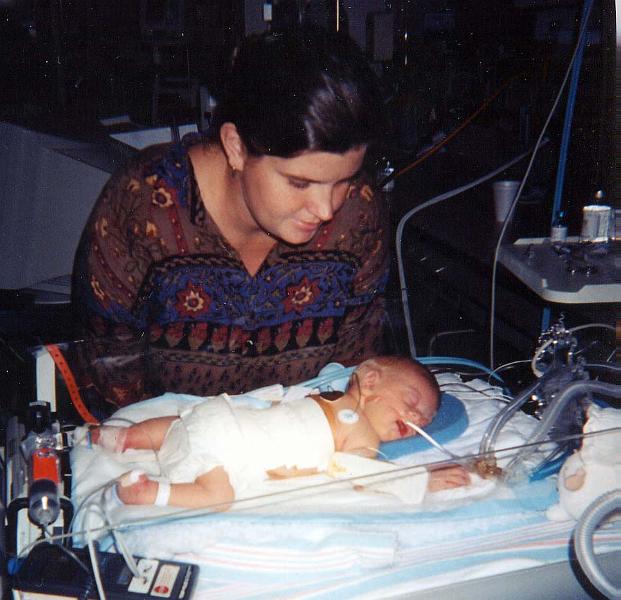 0-03.JPG - Carisa after her first operation to close her back.