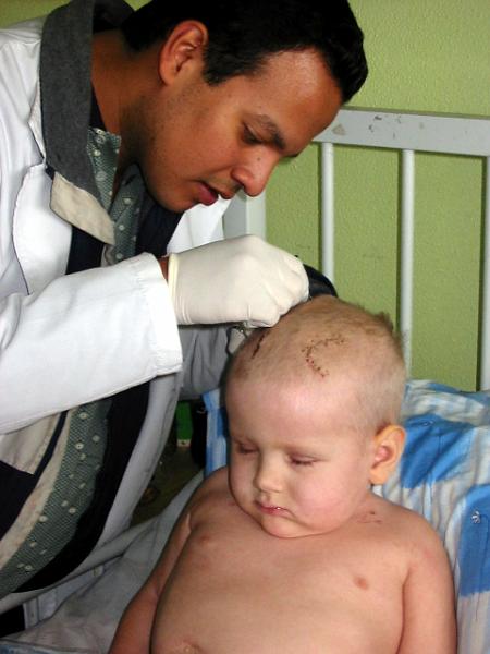 4-33.jpg - Mario, takes out the last stitches. Kika had over 60 in her head!